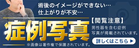 睾丸摘出・陰嚢切除・性別適合手術｜睾丸摘出専門 東京ジェン 